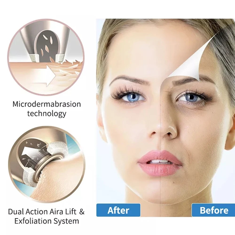 Diamond Microdermabrasion Machine
