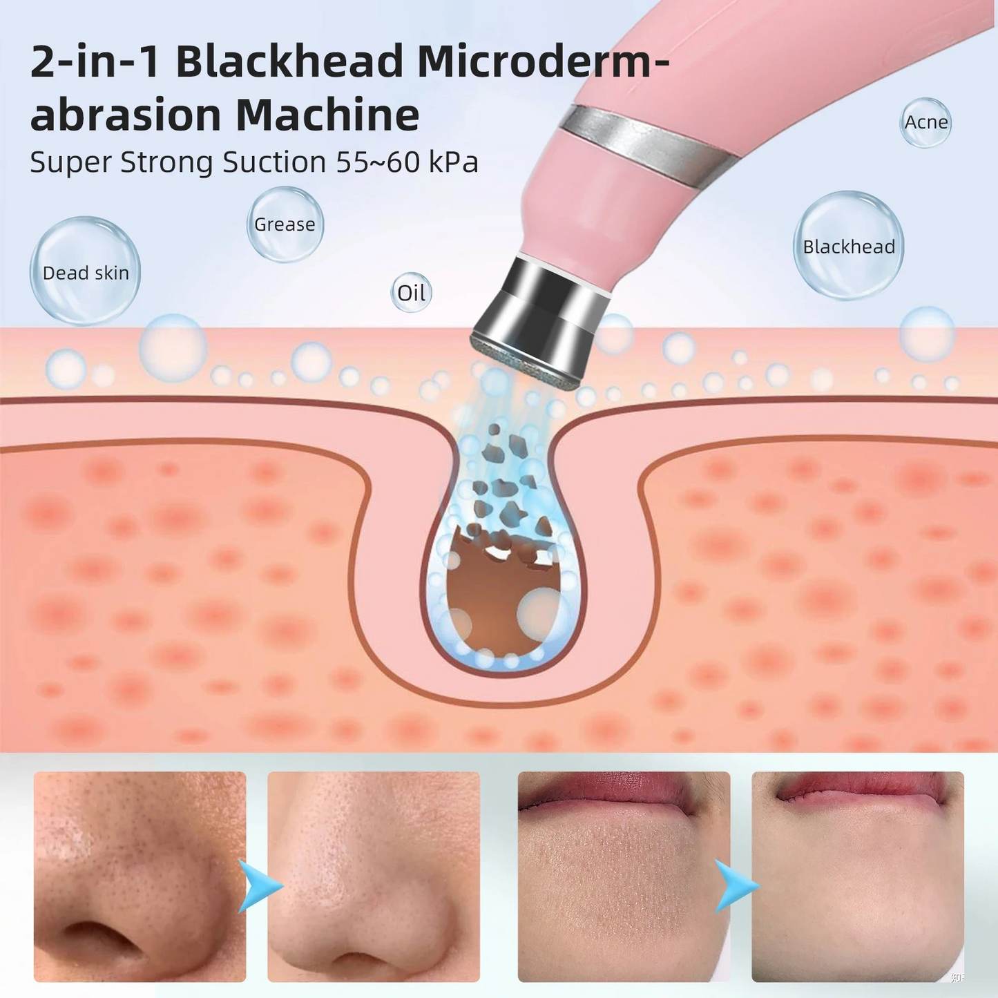 3 in 1 Diamond Microdermabrasion Machine