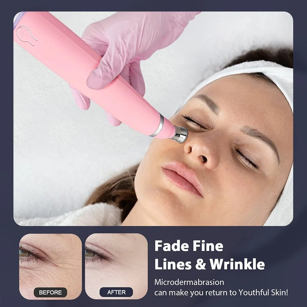 3 in 1 Diamond Microdermabrasion Machine