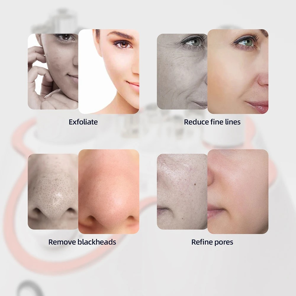 3 in 1 Diamond Microdermabrasion Machine